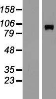DGKB Human Over-expression Lysate