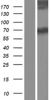 ASMTL Human Over-expression Lysate