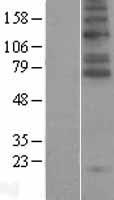 Glyt2 (SLC6A5) Human Over-expression Lysate