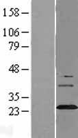 Synaptogyrin 3 (SYNGR3) Human Over-expression Lysate
