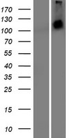 Malignant fibrous histiocytoma (MFHAS1) Human Over-expression Lysate