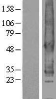 S1PR2 Human Over-expression Lysate