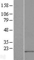 Surb7 (MED21) Human Over-expression Lysate
