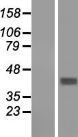 GNA14 Human Over-expression Lysate