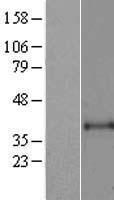ART1 Human Over-expression Lysate