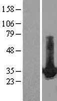 HDGF Human Over-expression Lysate