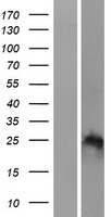 HOXB7 Human Over-expression Lysate