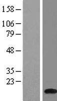 ATP6J (ATP6V1G1) Human Over-expression Lysate