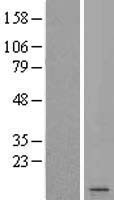 CSAG2 Human Over-expression Lysate