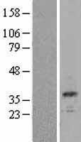 Calbindin (CALB1) Human Over-expression Lysate