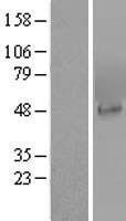 PIP5K2 alpha (PIP4K2A) Human Over-expression Lysate