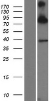 SIM1 Human Over-expression Lysate