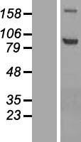 ADAMTS4 Human Over-expression Lysate