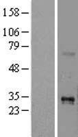 TL1A (TNFSF15) Human Over-expression Lysate