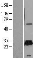 Retinal protein 4 (UNC119) Human Over-expression Lysate