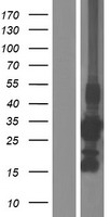 CCS Human Over-expression Lysate