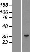 Aldolase C (ALDOC) Human Over-expression Lysate