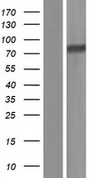 CBFA2T3 Human Over-expression Lysate
