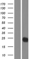CTLA4 Human Over-expression Lysate