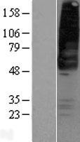 GPR42 Human Over-expression Lysate