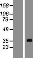 Acyl coenzyme A Thioesterase 8 (ACOT8) Human Over-expression Lysate