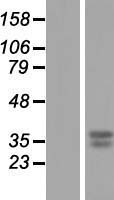 GNPDA1 Human Over-expression Lysate