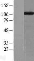CAF1 (CHAF1A) Human Over-expression Lysate