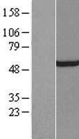 TFIIE alpha (GTF2E1) Human Over-expression Lysate