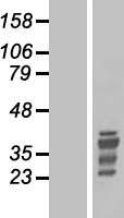HOX11 (TLX1) Human Over-expression Lysate