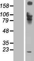 IL12RB1 Human Over-expression Lysate