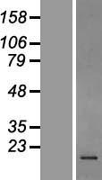 Stathmin 1 (STMN1) Human Over-expression Lysate