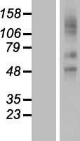 SLCO2A1 Human Over-expression Lysate