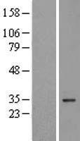 VDAC3 Human Over-expression Lysate