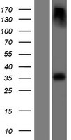 EPM2A Human Over-expression Lysate
