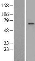 TAF1B Human Over-expression Lysate