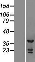 TSSC4 Human Over-expression Lysate