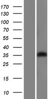 GIPC (GIPC1) Human Over-expression Lysate