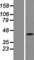 MADH7 (SMAD7) Human Over-expression Lysate