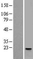 TSPAN31 Human Over-expression Lysate