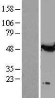 alpha Tubulin (TUBA1A) Human Over-expression Lysate