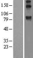 WFS1 Human Over-expression Lysate