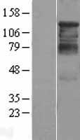 HDAC4 Human Over-expression Lysate