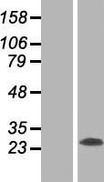 RTN3 Human Over-expression Lysate