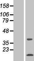 SNAPC5 Human Over-expression Lysate