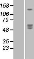 SIRPB1 Human Over-expression Lysate