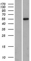 Ikaros (IKZF1) Human Over-expression Lysate