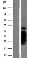 CITED2 Human Over-expression Lysate