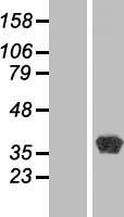 BPNT1 Human Over-expression Lysate