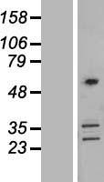 CORO2B Human Over-expression Lysate