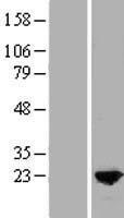 MYL9 Human Over-expression Lysate